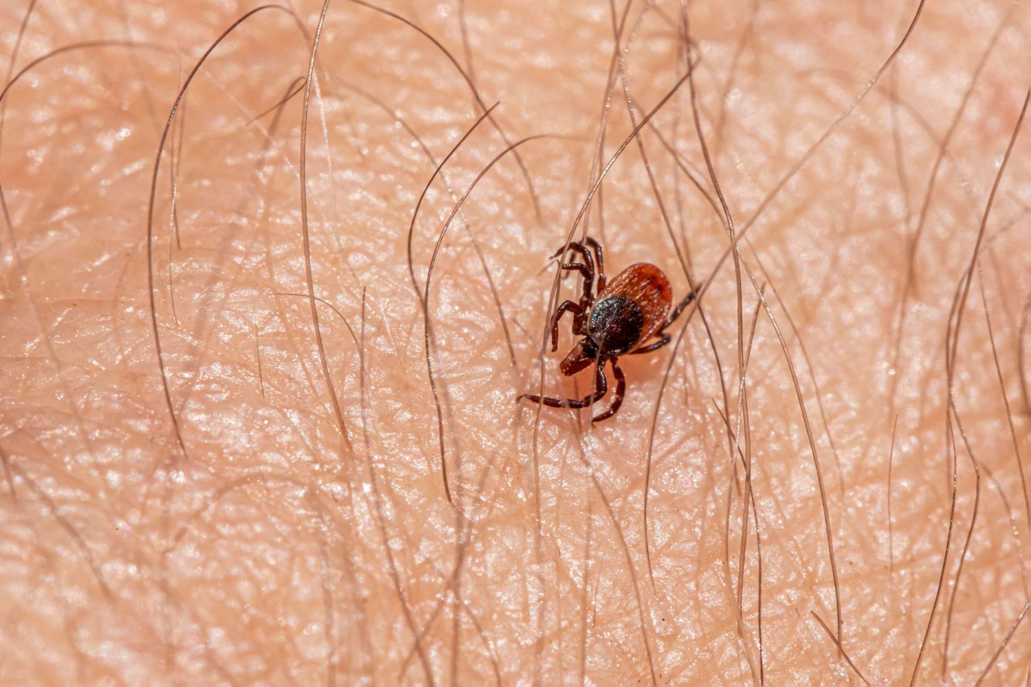 Cientistas descobrem que os minúsculos seres que vivem no seu rosto podem estar se tornando parte do corpo humano