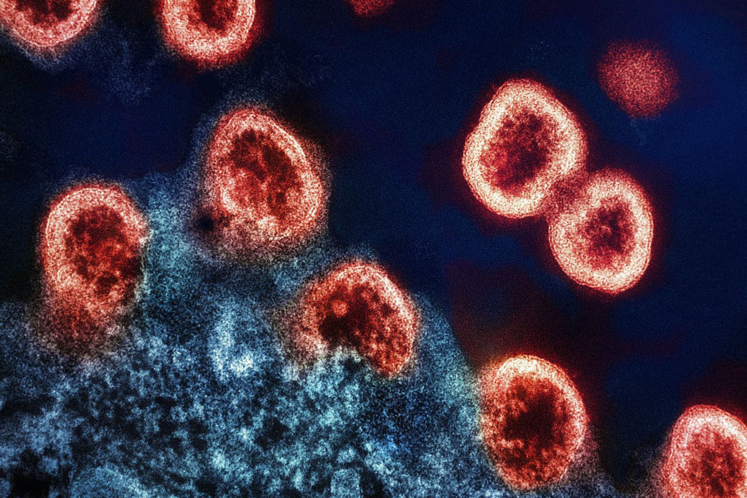 Cientistas usaram IA para criar vírus que não existiam na natureza e o resultado abre uma nova fronteira