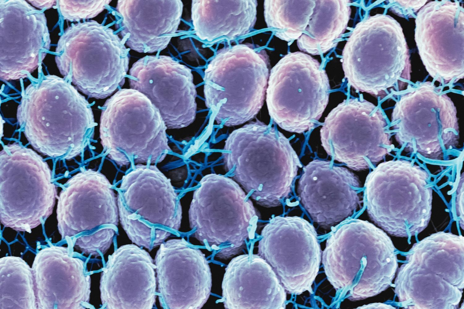 Cientistas mantiveram ‘minicérebros’ humanos vivos por quase seis anos e atravessaram uma barreira que parecia impossível