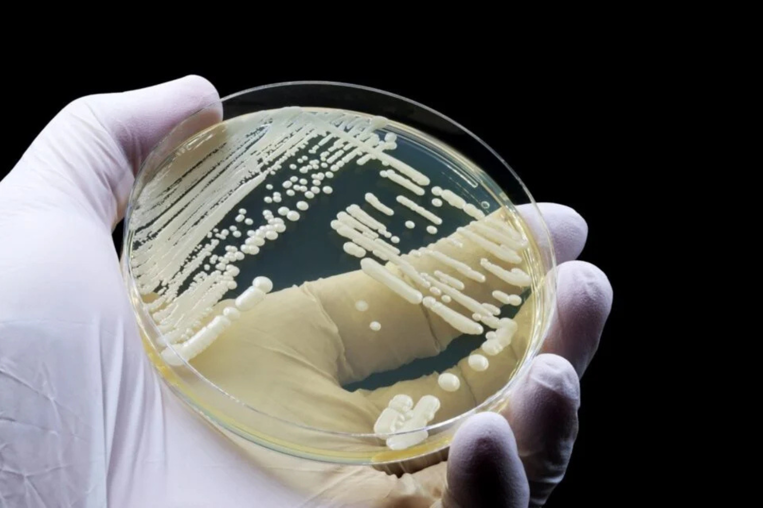 Fungo Mortal Resistente A Medicamentos Pode Se Esconder Na Pele — E Cientistas Descobriram Como
