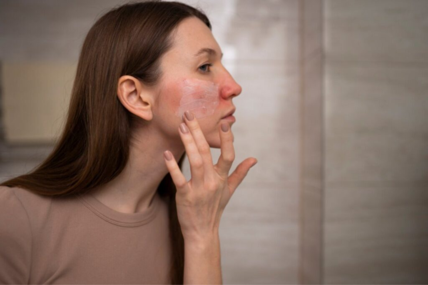 Hidroalergia1