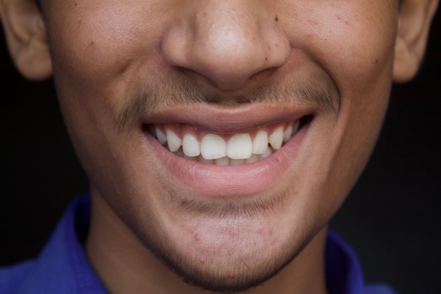 Água com gás pode atacar os dentes? A ciência revela o que acontece com o esmalte depois de cada gole
