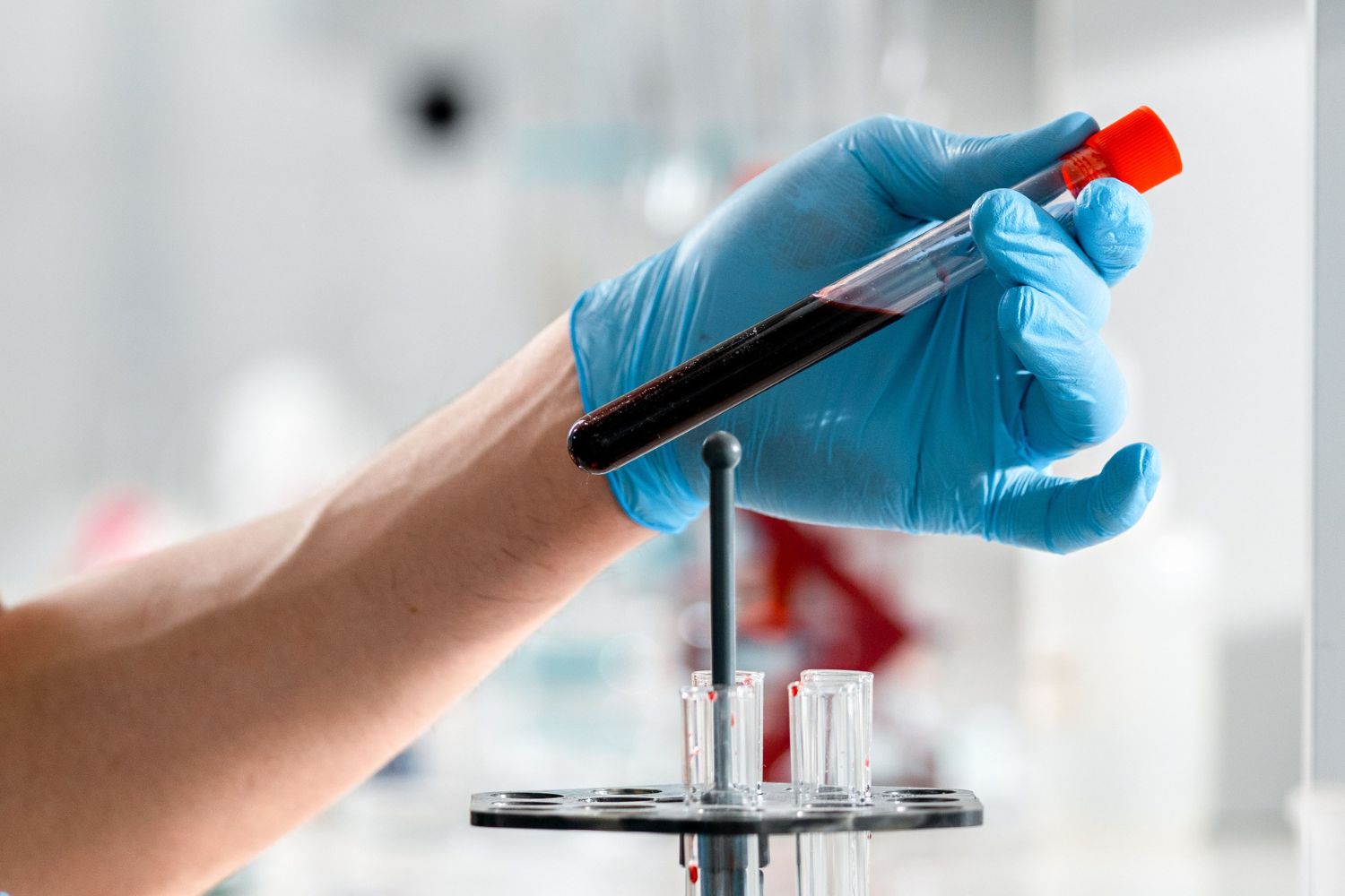 Uma combinação de dois medicamentos promete rejuvenescer o sangue e já atrai uma fila de interessados famosos