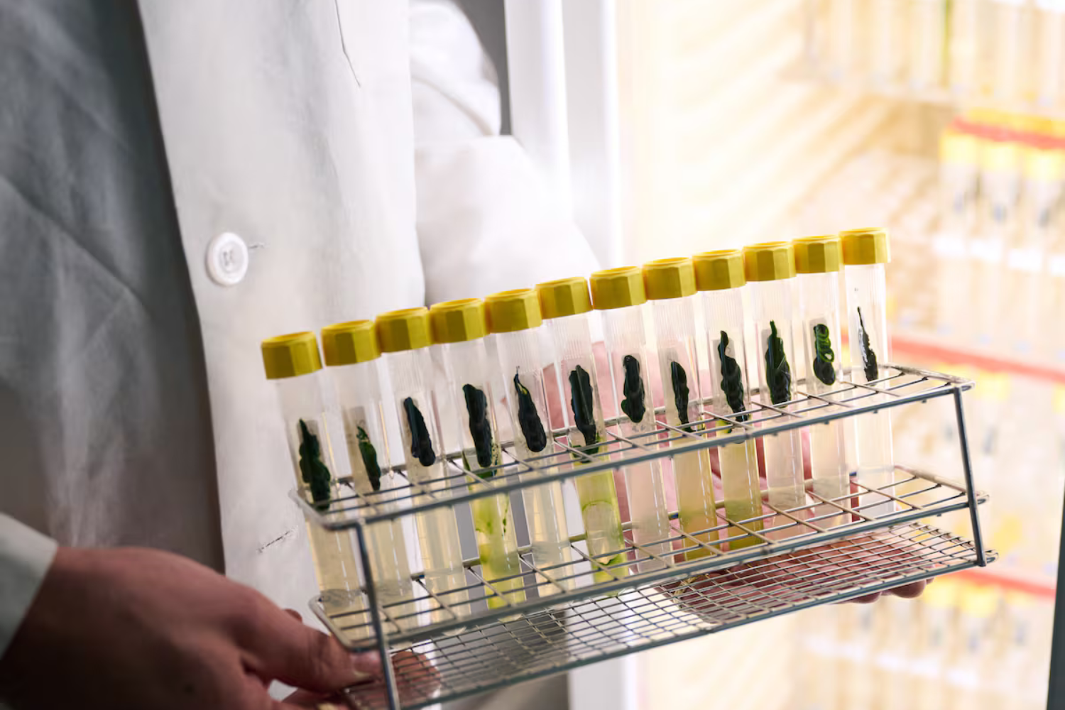 Cientistas Aprenderam A “ligar E Desligar” NeurôniOS Com Luz — E A Descoberta Ganhou O Nobel De Medicina