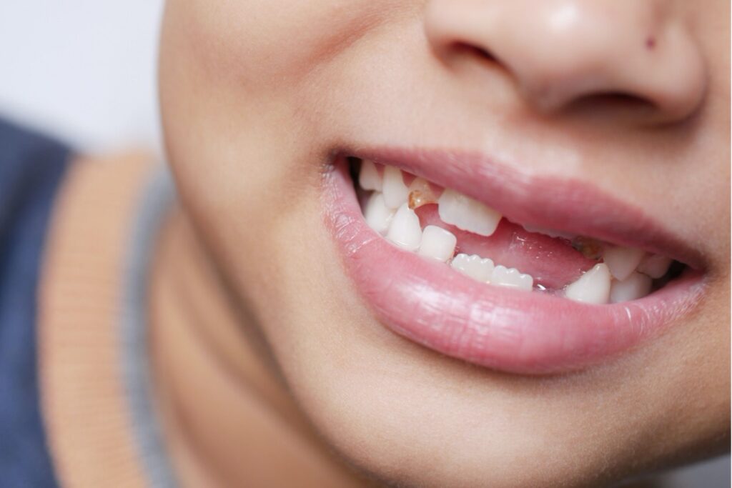 O que a ciência descobriu dentro dos dentes de leite pode abrir um novo caminho contra doenças raras