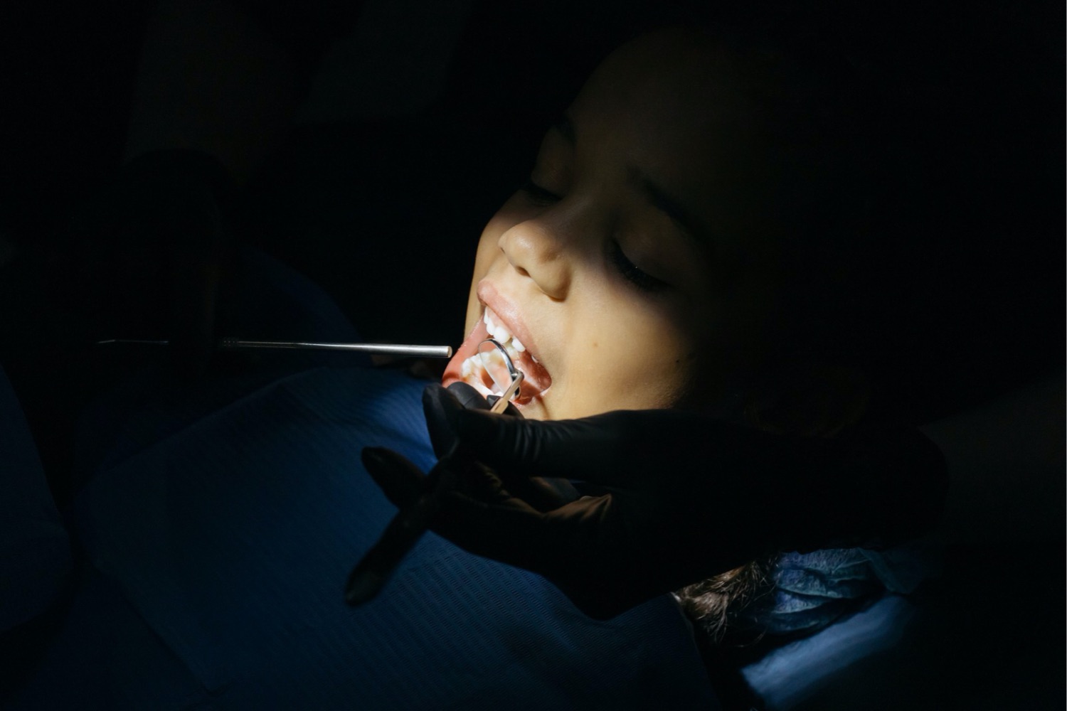 O que a ciência descobriu dentro dos dentes de leite pode abrir um novo caminho contra doenças raras