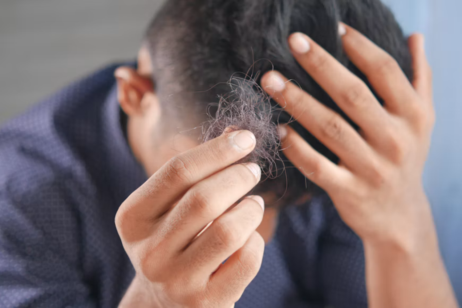 Queda De Cabelo Tem Causas Diferentes — E O Diagnóstico Muda O Tratamento