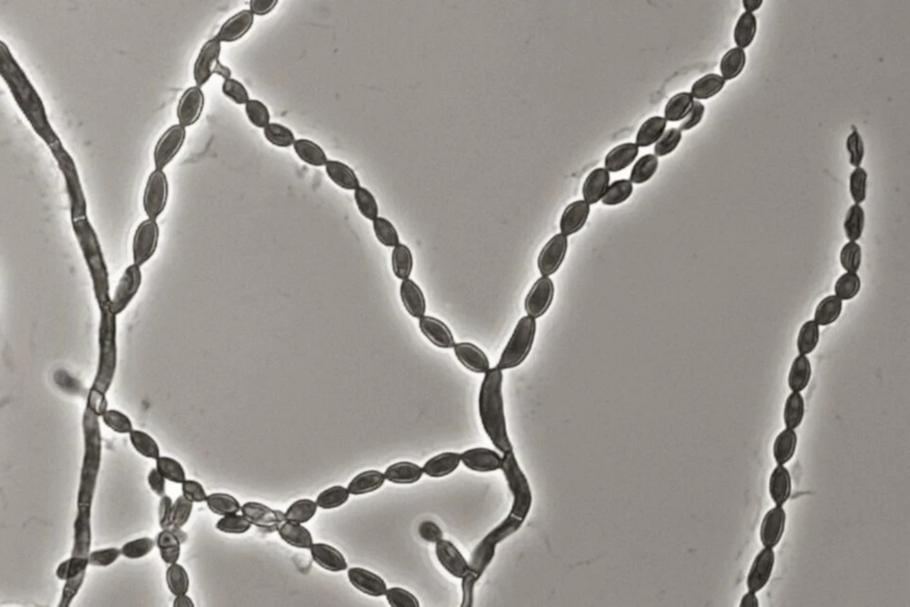 Um Fungo Que Ataca O Cérebro Está Aparecendo Mais, E Cientistas Ainda Não Sabem Por Quê