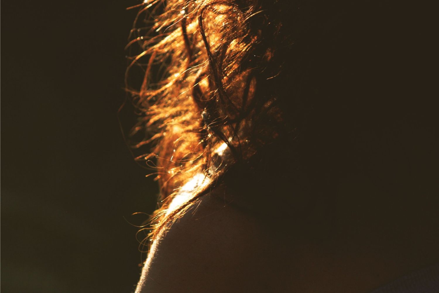 O segredo da queda de cabelo pode estar em microrganismos invisíveis que vivem na sua cabeça