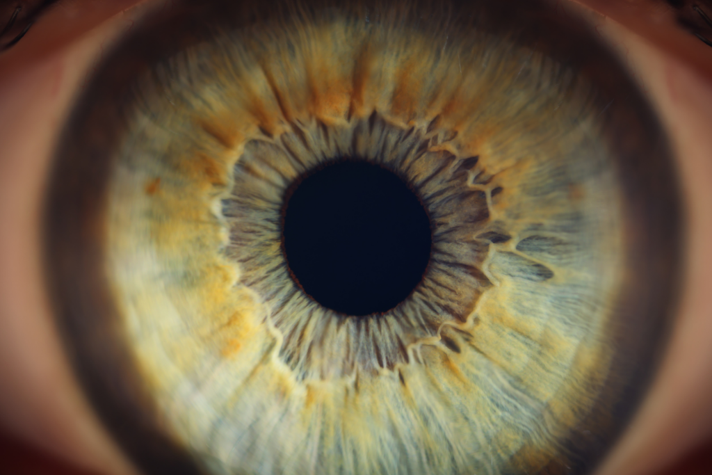 Retinite